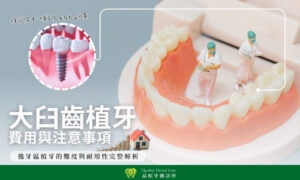牙科模型搭配醫師公仔與植牙結構圖,說明大臼齒植牙的費用與注意事項
