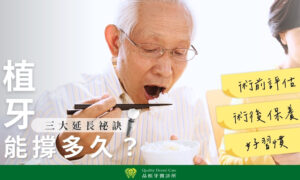 台中品植牙醫診所解析植牙能撐多久與延長壽命秘訣